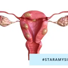 Mięśniaki macicy po menopauzie: Czy zanikają? Kiedy rosną?