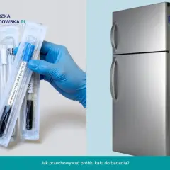 Próbka kału dzień wcześniej? Jak ją przechowywać, by wynik był pewny