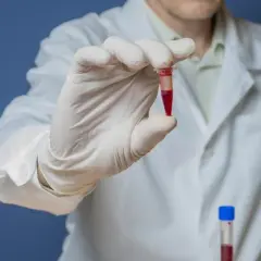 Laborant w białym fartuchu trzyma probówkę z czerwoną próbką, badając potencjalną bilirubina w moczu.
