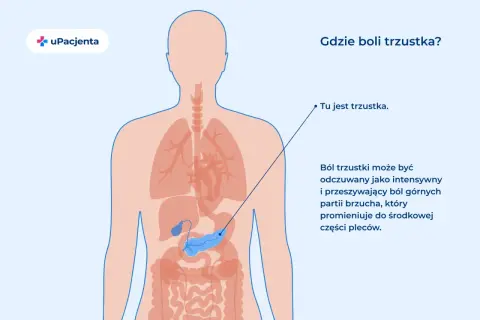 Ilustracja pokazuje lokalizację trzustki w ludzkim ciele. Ból trzustki może być intensywny i promieniować do pleców.