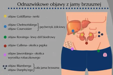 Ilustracja pokazuje lokalizację objawów wskazujących na ostry ból brzucha, np. objaw Cullena w okolicy pępka.