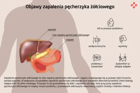 Objawy zapalenia pęcherzyka żółciowego: ból w prawym podżebrzu, wzdęcia, wymioty, problemy z trawieniem.