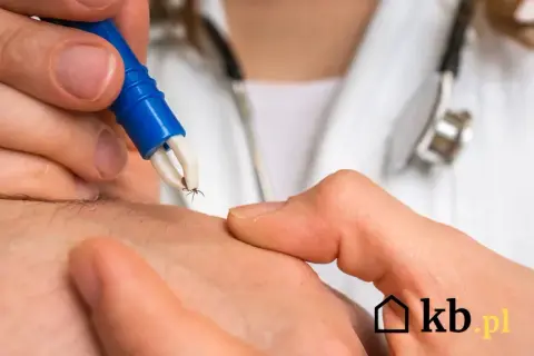 Borelioza: Ile kosztują badania? Cennik, NFZ i porady eksperta