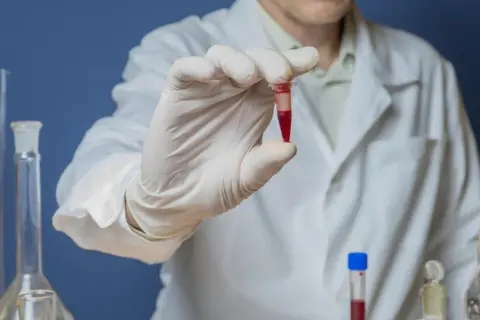 Laborant w białym fartuchu trzyma probówkę z czerwoną próbką, badając potencjalną bilirubina w moczu.