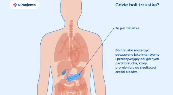 Ilustracja pokazuje lokalizację trzustki w ludzkim ciele. Ból trzustki może być intensywny i promieniować do pleców.