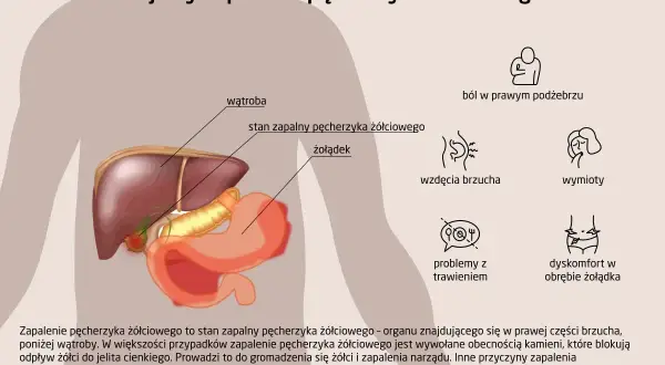 Objawy zapalenia pęcherzyka żółciowego: ból w prawym podżebrzu, wzdęcia, wymioty, problemy z trawieniem.