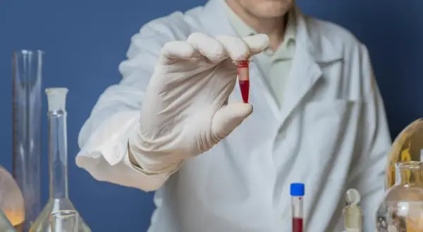 Laborant w białym fartuchu trzyma probówkę z czerwoną próbką, badając potencjalną bilirubina w moczu.
