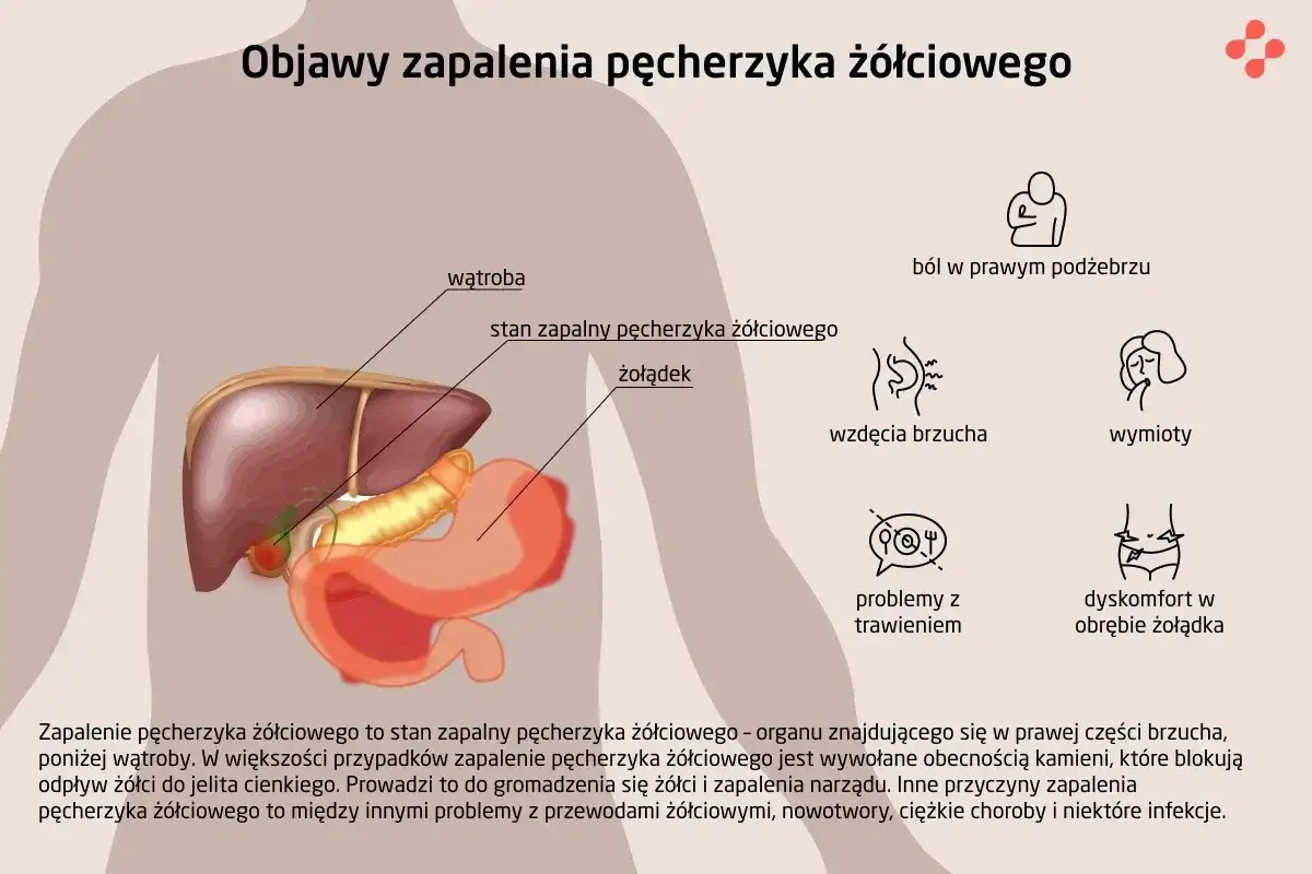 Objawy pęcherzyka żółciowego - kolka, zapalenie i alarmowe sygnały