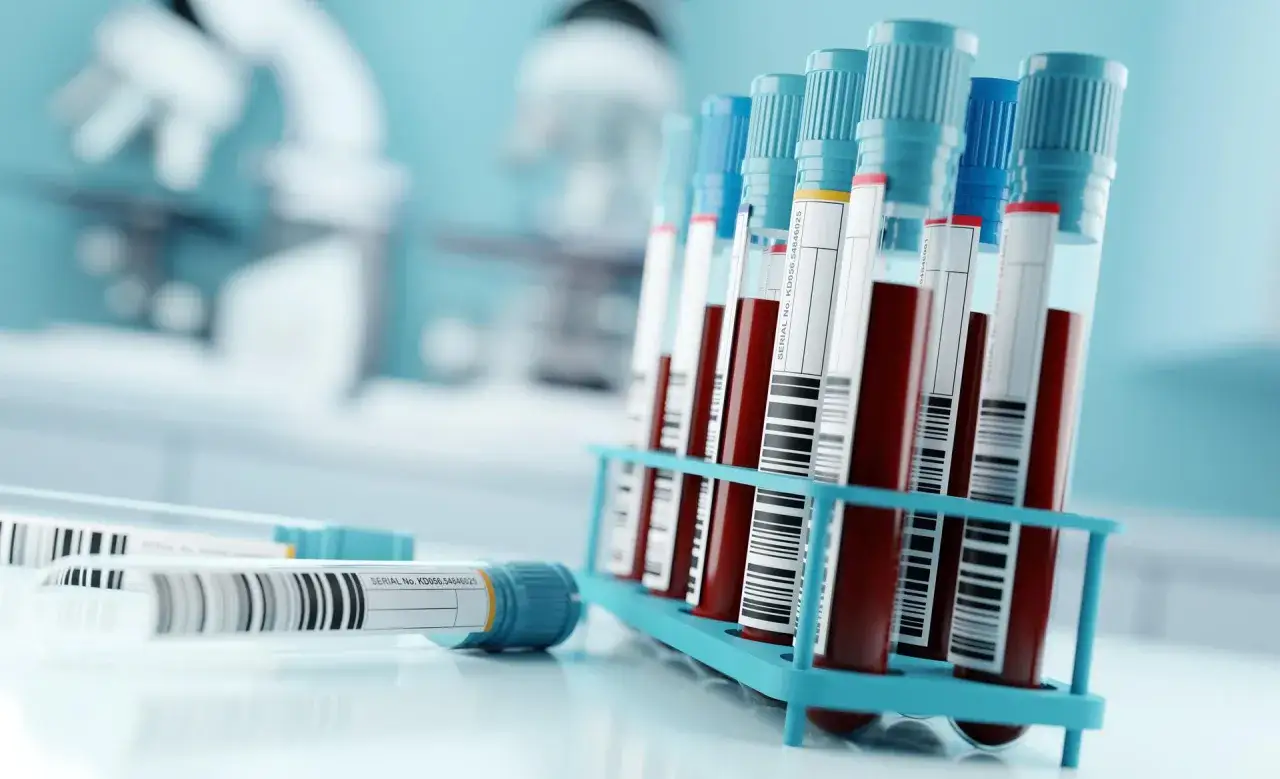 schemat badań hormonalnych kobieta, probówki z krwią badania