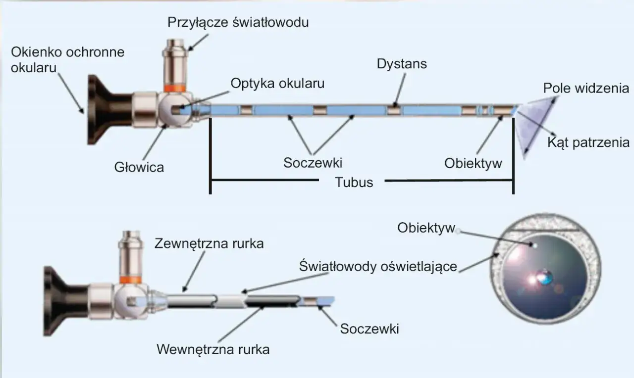 r&oacute;żne rodzaje endoskopii schemat