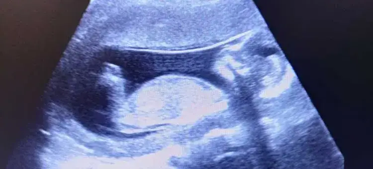 USG 17 tydzień ciąży rozwój płodu