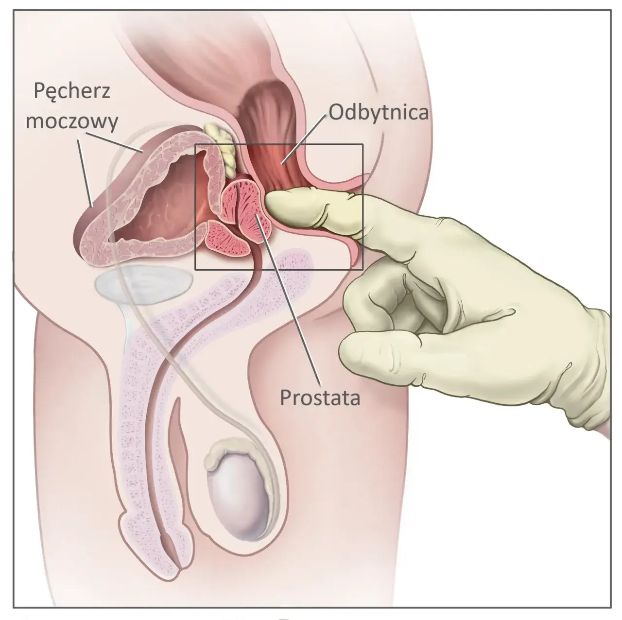 urolog badanie per rectum schemat