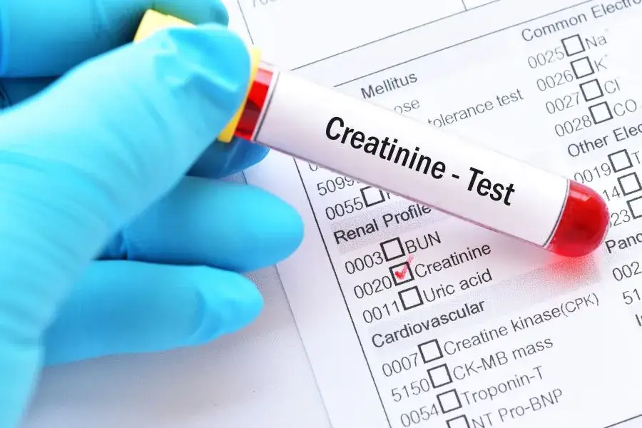 badanie kreatyniny laboratorium pobranie krwi