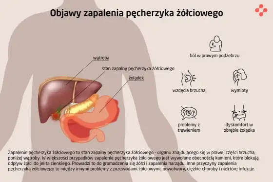 Objawy pęcherzyka żółciowego - kolka, zapalenie i alarmowe sygnały
