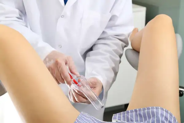 Ginekolog w białym fartuchu i rękawiczkach trzyma wziernik ginekologiczny.