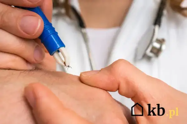 Borelioza: Ile kosztują badania? Cennik, NFZ i porady eksperta